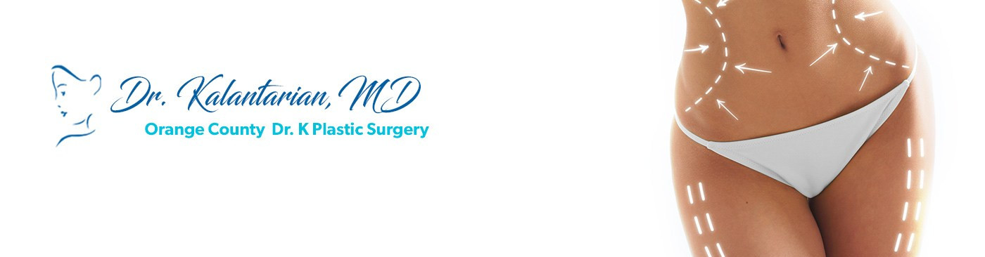 Westminster Liposuction